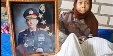Kapolri Merespons Permintaan Sinta Aulia, Anak Penderita Tumor Kaki
